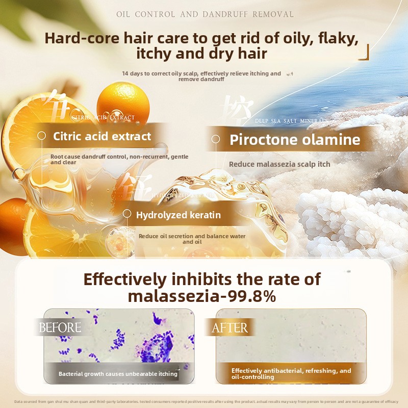 Oil control fluffy shampoo dan - Perfume Fragrance Shampoo review and price